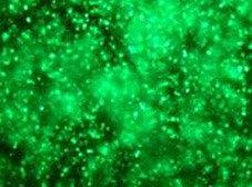 Human PBMC transfection with GFP plasmid