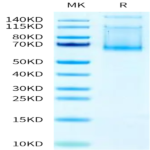 Mouse ADAM9 Protein (ADM-MM109)