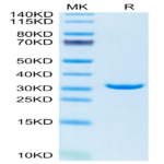 Human Annexin V/ANXA5 Protein (AN5-HE005)