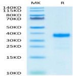 Human ANGPTL7/CDT6 Protein (ANG-HM407)
