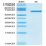 Human Serum Albumin Protein (BSA-HM401)