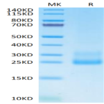 Human CD69/CLEC2C Protein (CD6-HM196)