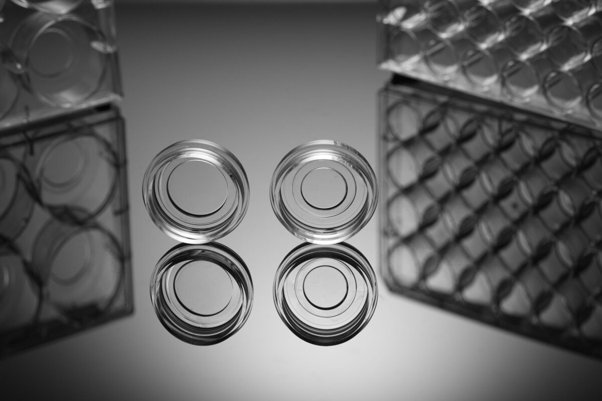 Glass Bottom Cell Culture Dish (801002) Nest Ushelf