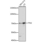 TFE3 Rabbit mAb (A0548)