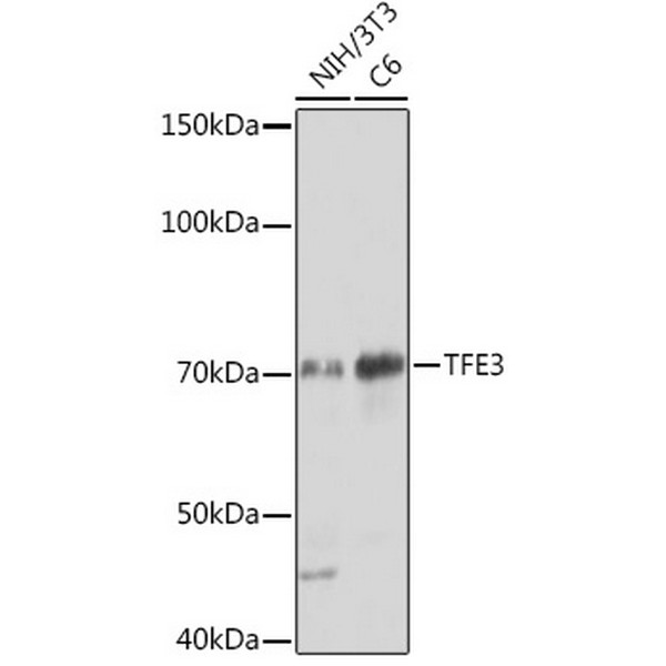 TFE3 Rabbit mAb (A0548) TFE3 Rabbit mAb (A0548)