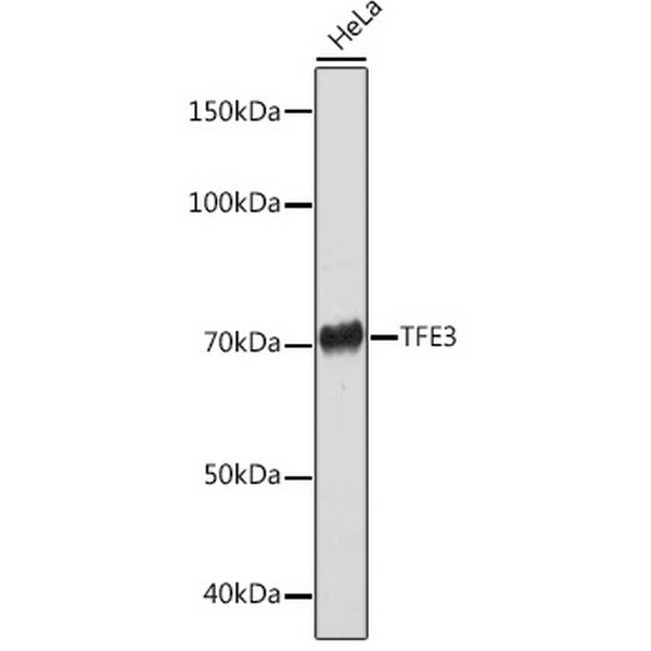 A0548: TFE3 Rabbit mAb