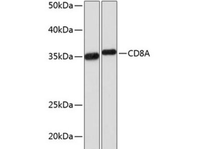 CD8A Rabbit mAb (A0663)
