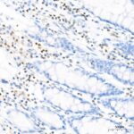 IGF1 Rabbit mAb (A0830)