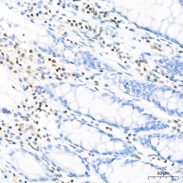IGF1 Rabbit mAb (A0830) IGF1 Rabbit mAb (A0830)