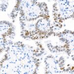 IGF1 Rabbit mAb (Catalog Number: A0830) Abclonal