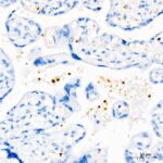 Abclonal IGF1 Rabbit mAb (Catalog Number: A0830)