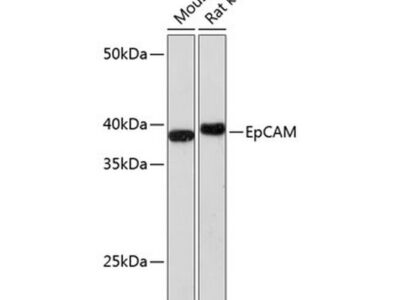 EpCAM Rabbit mAb (A1107)