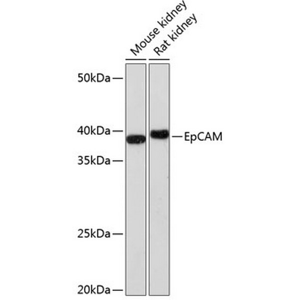 EpCAM Rabbit mAb (A1107) EpCAM Rabbit mAb (A1107)
