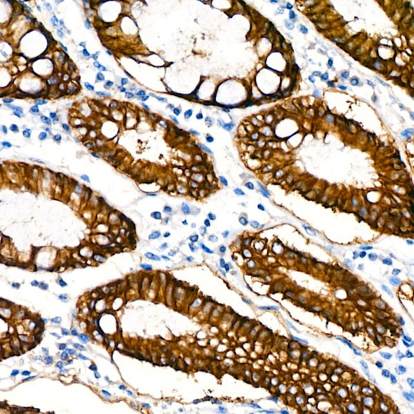 EpCAM Rabbit mAb (Catalog Number: A1107) Abclonal