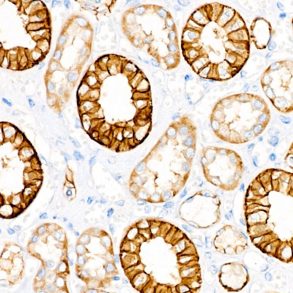 Abclonal EpCAM Rabbit mAb (Catalog Number: A1107)