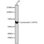 Cytokeratin 5 (CK5) Rabbit mAb (A11396)