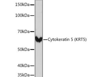 Cytokeratin 5 (CK5) Rabbit mAb (A11396)