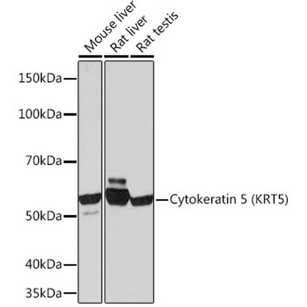A11396: Cytokeratin 5 (CK5) Rabbit mAb
