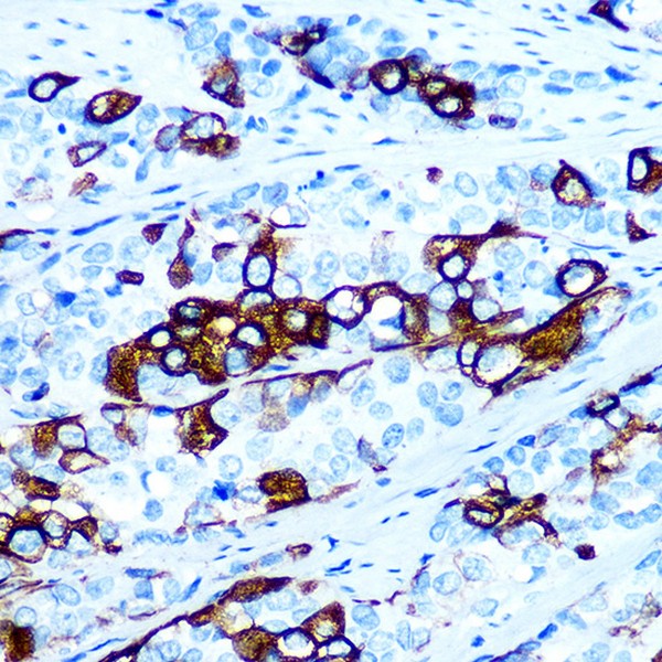 Cytokeratin 5 (CK5) Rabbit mAb (Catalog Number: A11396) Abclonal