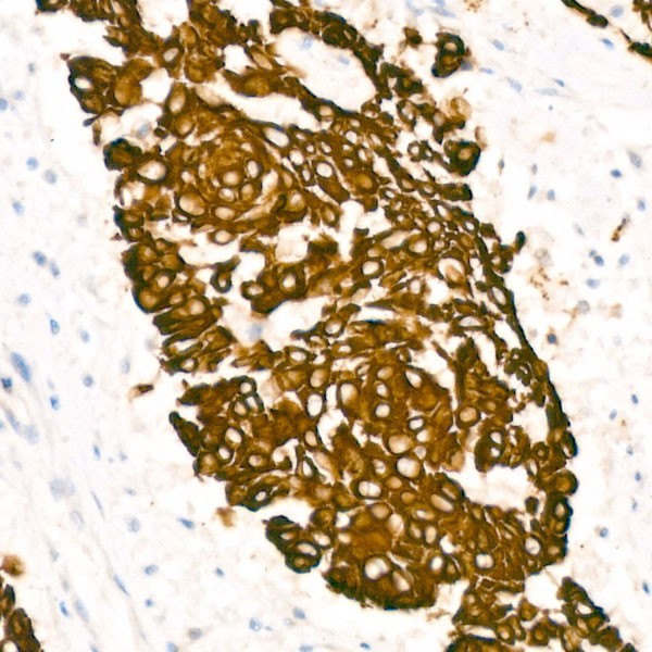 Abclonal Cytokeratin 5 (CK5) Rabbit mAb (Catalog Number: A11396)