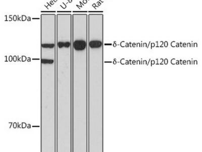 δ-Catenin/p120 Catenin Rabbit mAb (A11399)