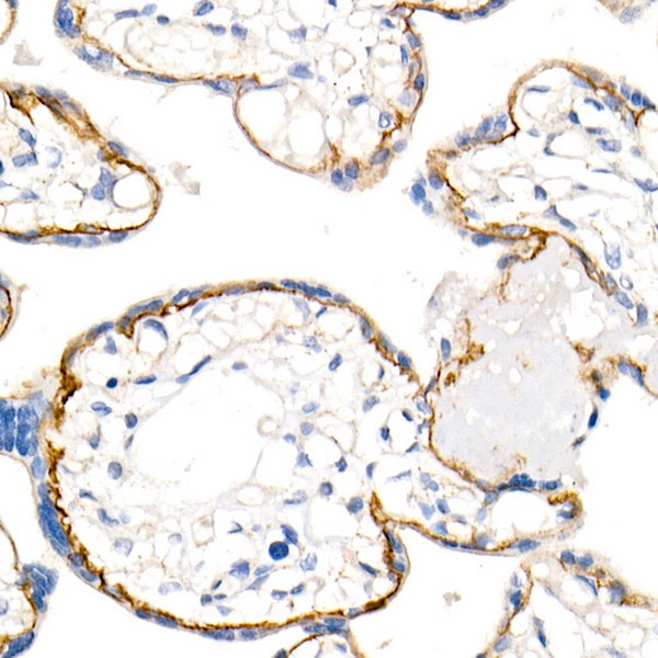 δ-Catenin/p120 Catenin Rabbit mAb (Catalog Number: A11399)