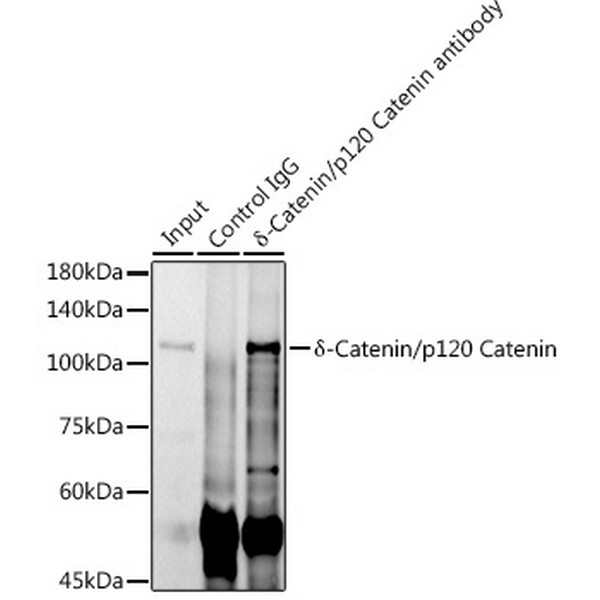 Abclonal δ-Catenin/p120 Catenin Rabbit mAb (Catalog Number: A11399)