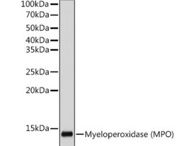 Myeloperoxidase (MPO) Rabbit mAb (A12109)
