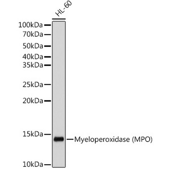 Myeloperoxidase (MPO) Rabbit mAb (A12109) Abclonal Ushelf
