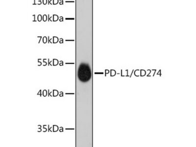 PD-L1/CD274 Rabbit mAb (A18103)