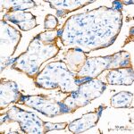 PD-L1/CD274 Rabbit mAb (Catalog Number: A18103) Abclonal