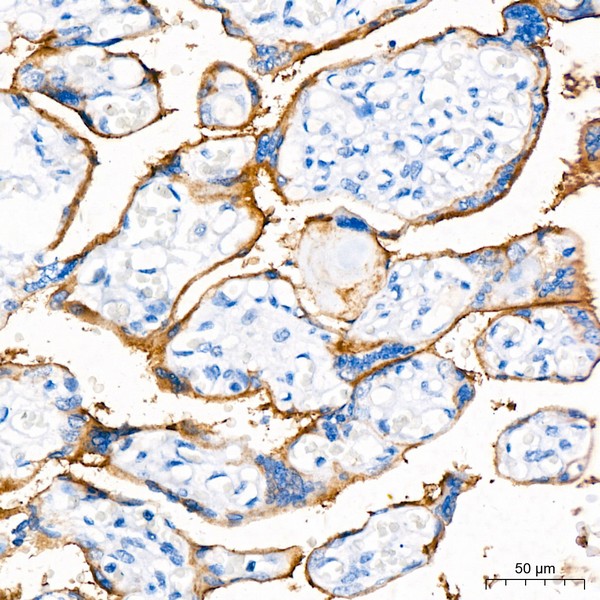 PD-L1/CD274 Rabbit mAb (Catalog Number: A18103) Abclonal