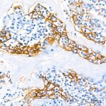 Abclonal PD-L1/CD274 Rabbit mAb (Catalog Number: A18103)