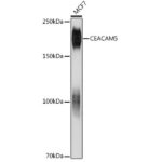 CEACAM5 Mouse mAb (A18131)