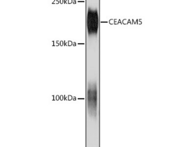 CEACAM5 Mouse mAb (A18131)