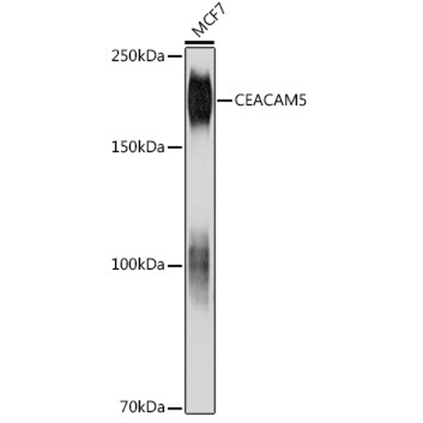 CEACAM5 Mouse mAb (A18131) CEACAM5 Mouse mAb (A18131)