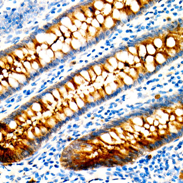 A18131: CEACAM5 Mouse mAb