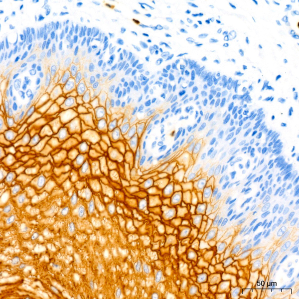 CEACAM5 Mouse mAb (Catalog Number: A18131) Abclonal