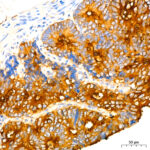 Abclonal CEACAM5 Mouse mAb (Catalog Number: A18131)