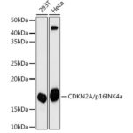 CDKN2A/p16INK4a Mouse mAb (A18219)
