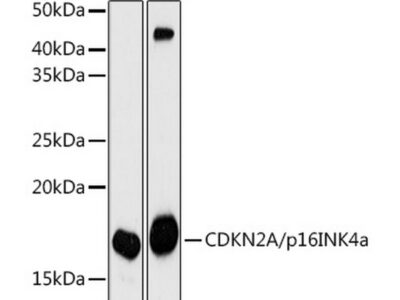 CDKN2A/p16INK4a Mouse mAb (A18219)
