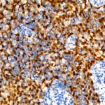 A18219: CDKN2A/p16INK4a Mouse mAb