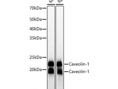 Caveolin-1 Rabbit mAb (A19006)