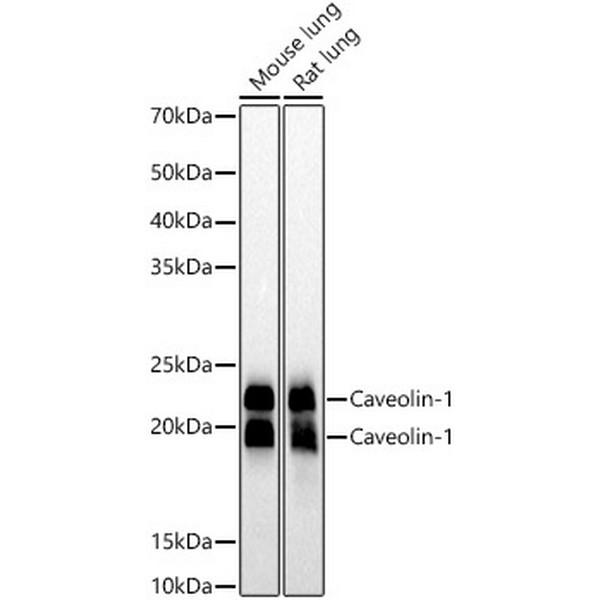 Caveolin-1 Rabbit mAb (A19006) Caveolin-1 Rabbit mAb (A19006)
