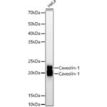 A19006: Caveolin-1 Rabbit mAb