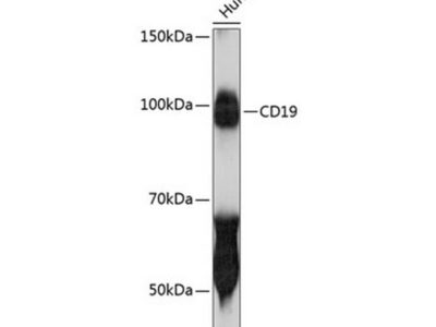 CD19 Rabbit mAb (A19013)