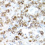 CD19 Rabbit mAb (Catalog Number: A19013) Abclonal