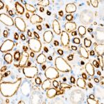 CD31/PECAM1 Rabbit mAb (Catalog Number: A19014) Abclonal