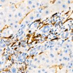 Abclonal CD31/PECAM1 Rabbit mAb (Catalog Number: A19014)