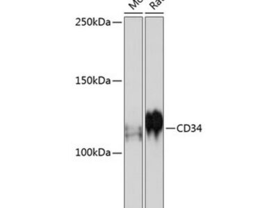 CD34 Rabbit mAb (A19015)